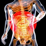 Kifoplasti: Osteoporotik Omurga Kırıklarında Etkin ve Güvenli Tedavi Yöntemi