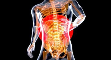 Kifoplasti: Osteoporotik Omurga Kırıklarında Etkin ve Güvenli Tedavi Yöntemi