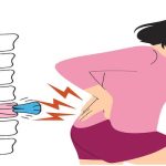 Omurga Kırıklarında En Etkili Tedavi Hangisi? Yeni Bilimsel Analiz Cevaplıyor