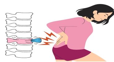 Omurga Kırıklarında En Etkili Tedavi Hangisi? Yeni Bilimsel Analiz Cevaplıyor