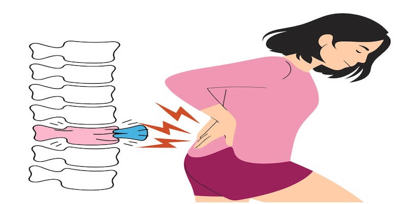 Omurga Kırıklarında En Etkili Tedavi Hangisi? Yeni Bilimsel Analiz Cevaplıyor