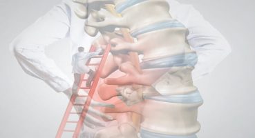 Ameliyatsız Bel Kayması Tedavisi Mümkün mü? Ne Zaman Cerrahi Gerekir?