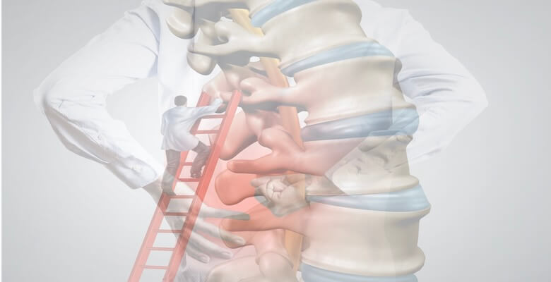 Ameliyatsız Bel Kayması Tedavisi Mümkün mü? Ne Zaman Cerrahi Gerekir?